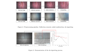 Sparse-then-Dense Alignment based 3D Map Reconstruction Method for Endoscopic Capsule Robots