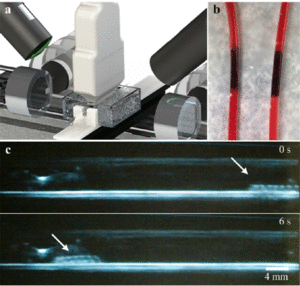 Mechanical rubbing of blood clots using helical robots under ultrasound guidance
