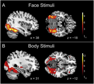 Decoding subcategories of human bodies from both body- and face-responsive cortical regions
