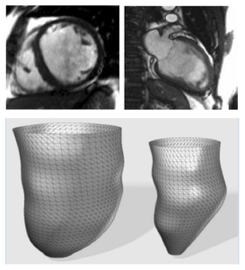 Left Ventricular Regional Wall Curvedness and Wall Stress in Patients with Ischemic Dilated Cardiomyopathy