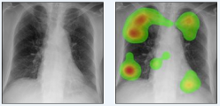 Role of expertise and contralateral symmetry in the diagnosis of pneumoconiosis: an experimental study