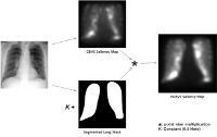 A Study of X-Ray Image Perception for Pneumoconiosis Detection