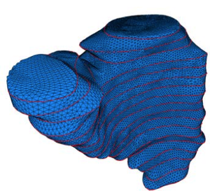 Model Reconstruction of Patient-Specific Cardiac Mesh from Segmented Contour Lines